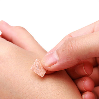 Igłi akupunktury z plastikową rączką, dociskowe, GB 2024-2016 Standard bezpieczeństwa dla skutecznego i komfortowego leczenia