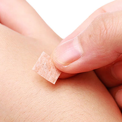 100 sztuk na pudełko Igły do prasy akupunktury z plastikowym uchwytem i metodą sterylizacji tlenku etylenu